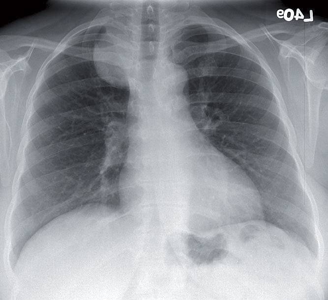 Read more about the article Shoulder Pain in a 49-year-old Woman