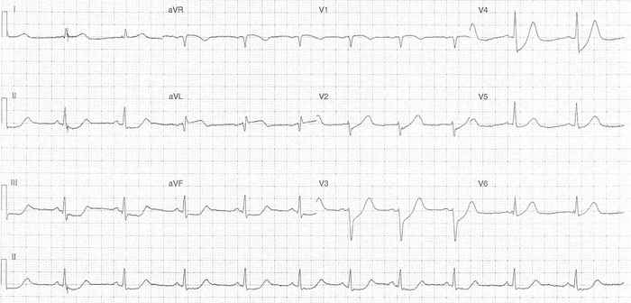 Read more about the article ECG Case 344