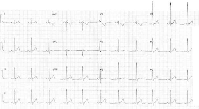 Read more about the article ECG Case 347