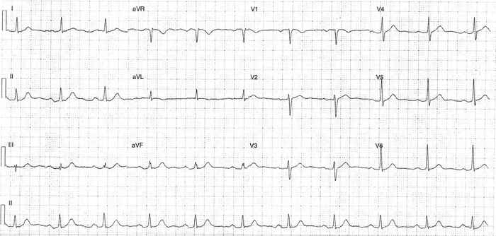 Read more about the article ECG Case 349